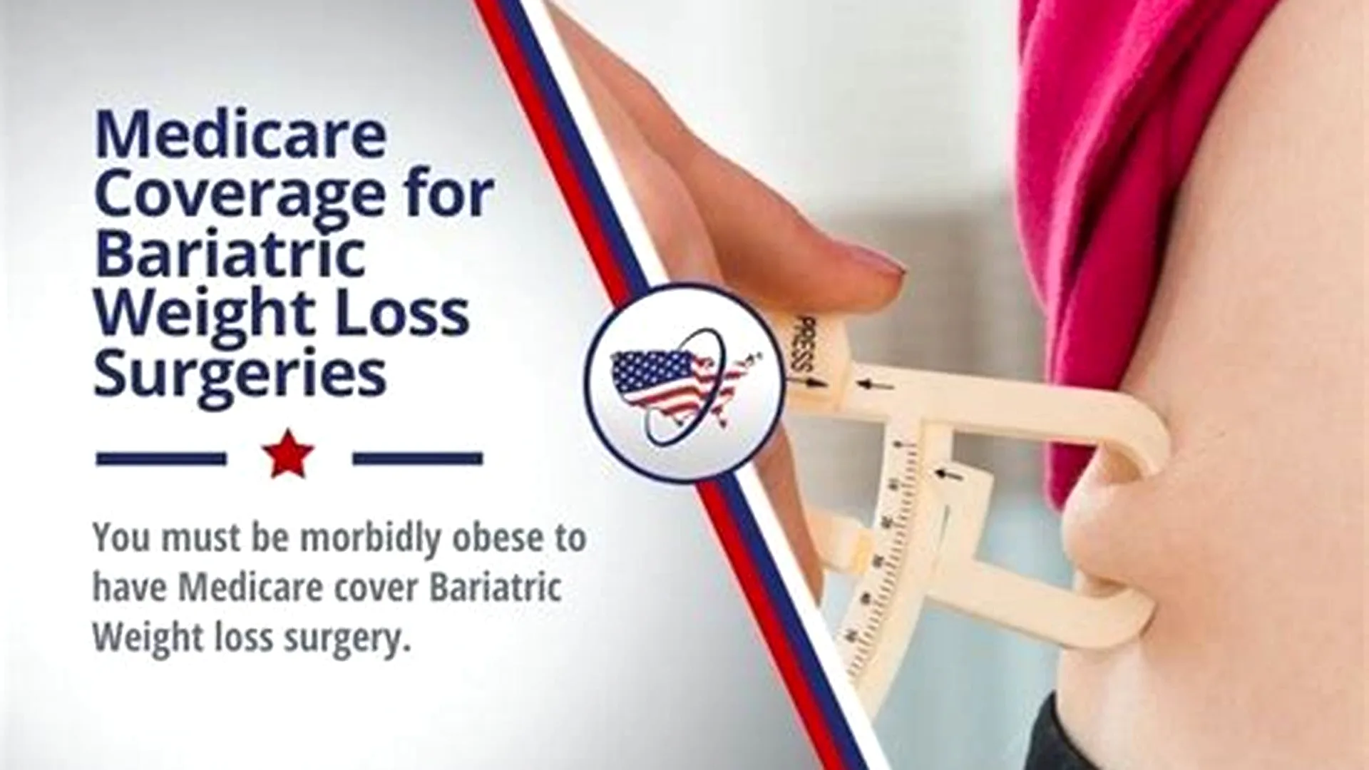 Medicare coverage of weight loss drug